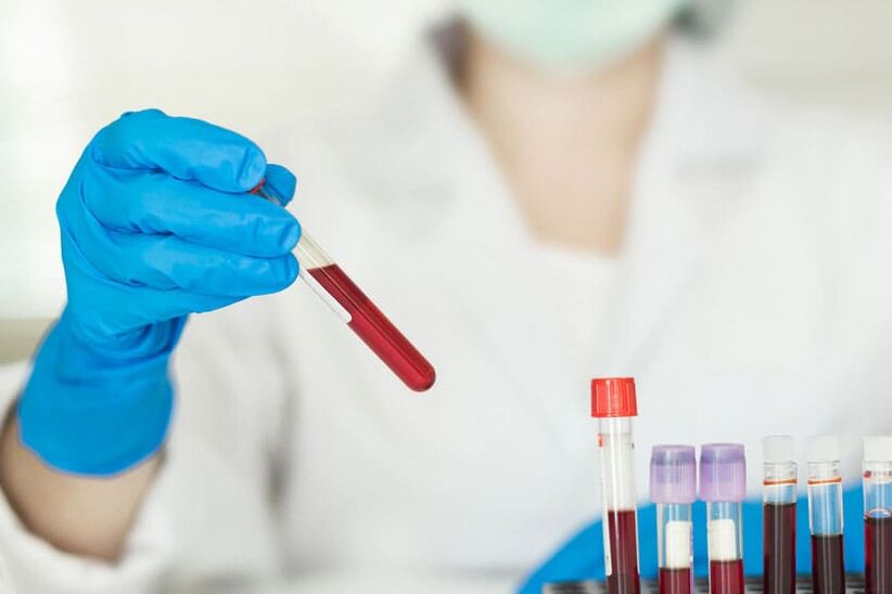 Pódese beber alcol antes de doar sangue